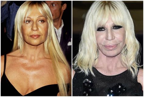 donatella versace prima e dopo la chirurgia|donatella versace without make up.